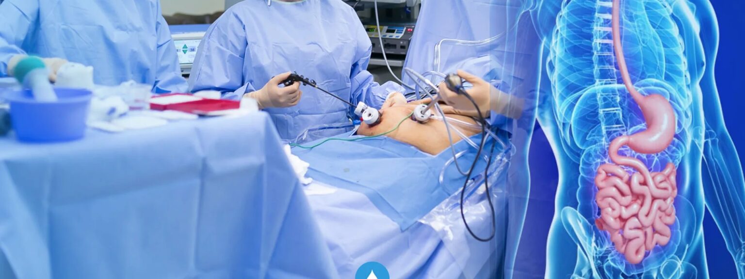 Laparoscopic digestive surgery and gastrointestinal anatomy